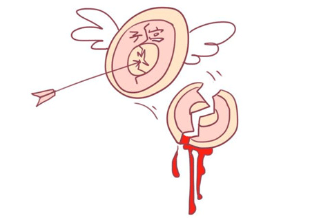 剖腹产的妈妈有哪些后遗症