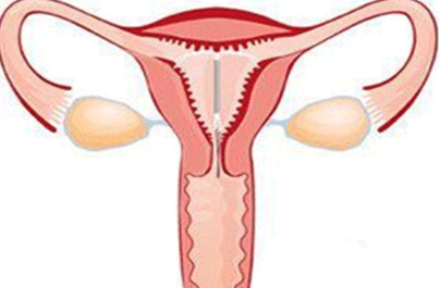 节育环移位怎么办
