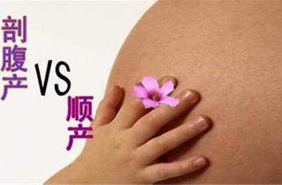 顺产好还是剖宫产好