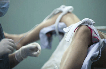 人工流产的并发症有哪些