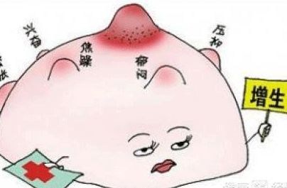 乳腺小叶增生症状