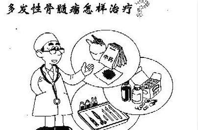 多发性骨髓瘤的治疗